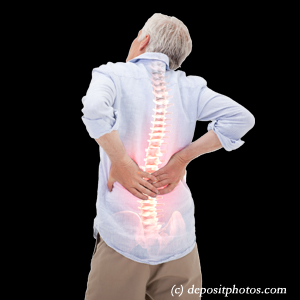 image Manahawkin back pain with lumbar spinal stenosis